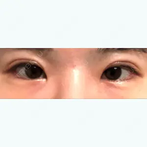 101 days after image
