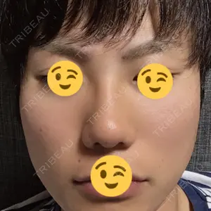31 days after image