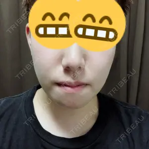 124 days after image