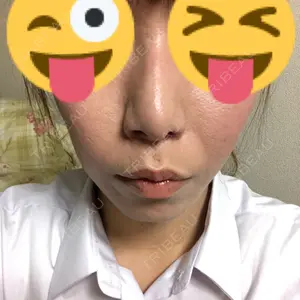 92 days after image