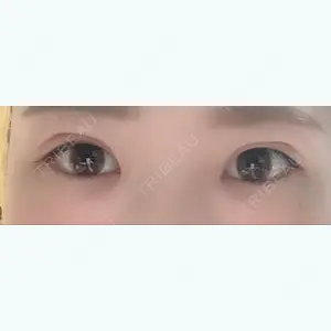 53 days after image
