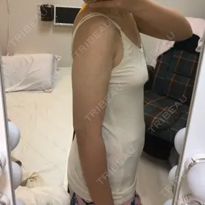 15 days after image