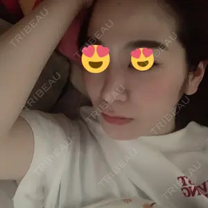 70 days after image