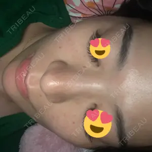 17 days after image