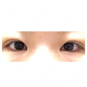 17 days after image