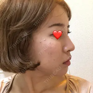 17 days after image