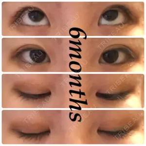 180 days after image