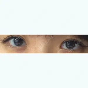 56 days after image