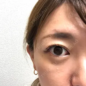 9 days after image