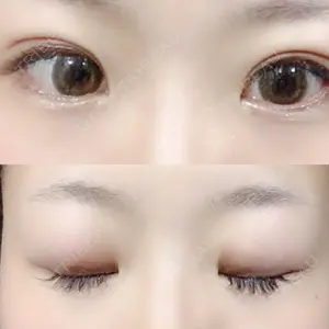 61 days after image