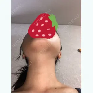 134 days after image