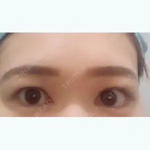8 days after image