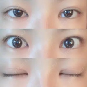134 days after image