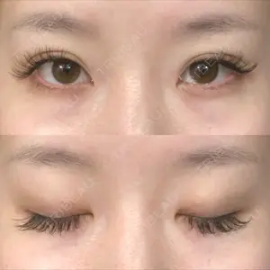 17 days after image