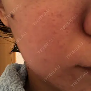 33 days after image