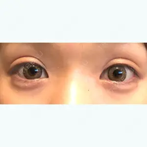 27 days after image