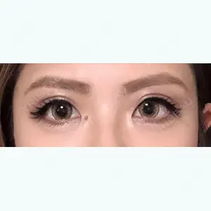 19 days after image