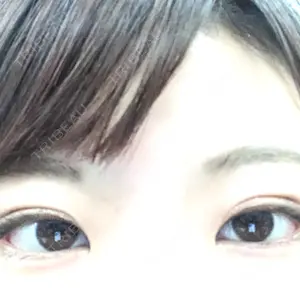 61 days after image