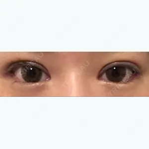 口コミ