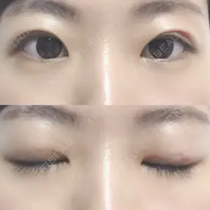 49 days after image
