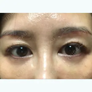 14 days after image