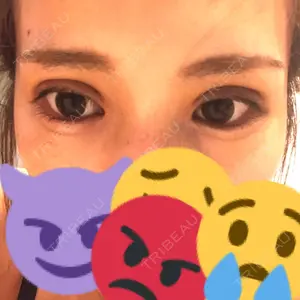3 days after image