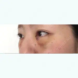 3 days after image