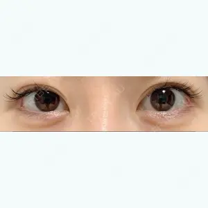 135 days after image