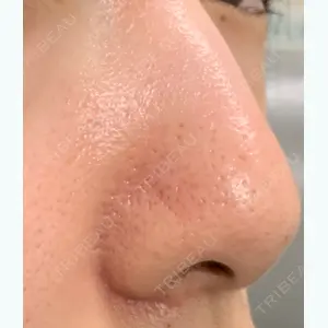 23 days after image