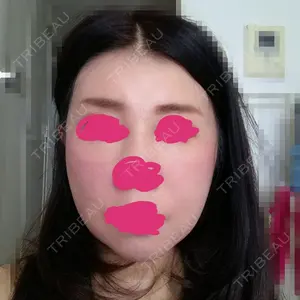 44 days after image