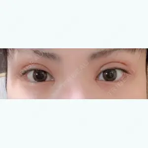 7 days after image