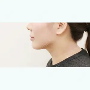 380 days after image