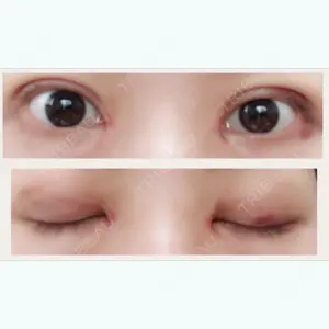 7 days after image