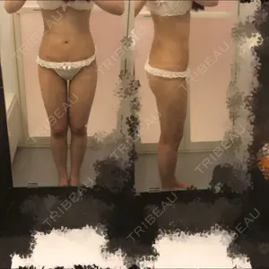 14 days after image