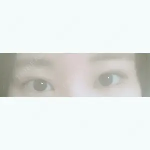 92 days after image