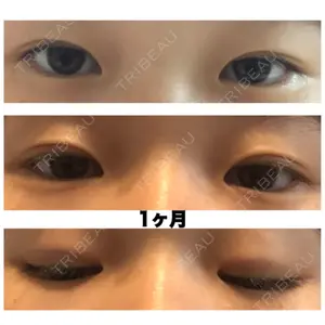 31 days after image