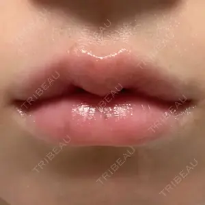 12 days after image