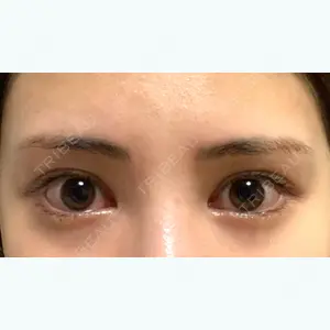 185 days after image