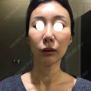 口コミ