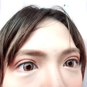 15 days after image