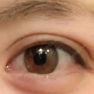 30 days after image