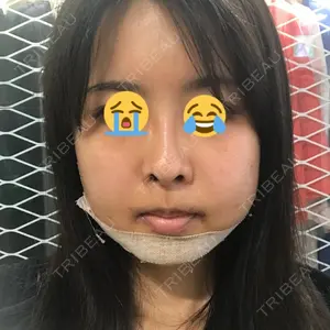 5 days after image