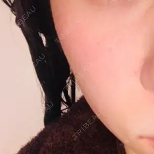 10 days after image