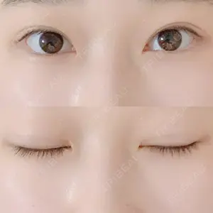 32 days after image