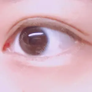19 days after image