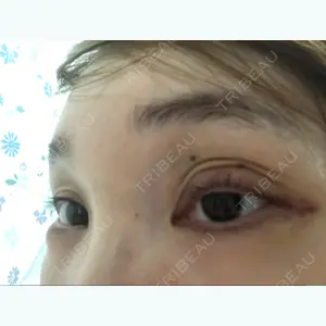 7 days after image