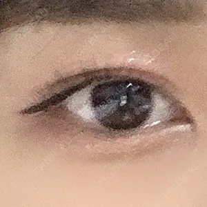 131 days after image