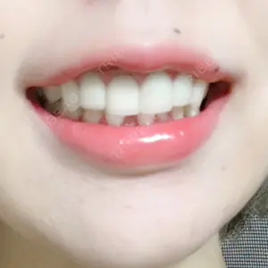 145 days after image