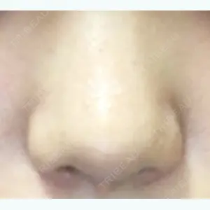 122 days after image