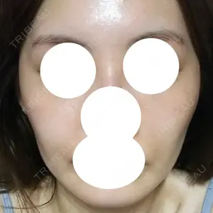 6 days after image